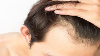 5 Reasons Why You Shouldn't Get a Hair Transplant Abroad